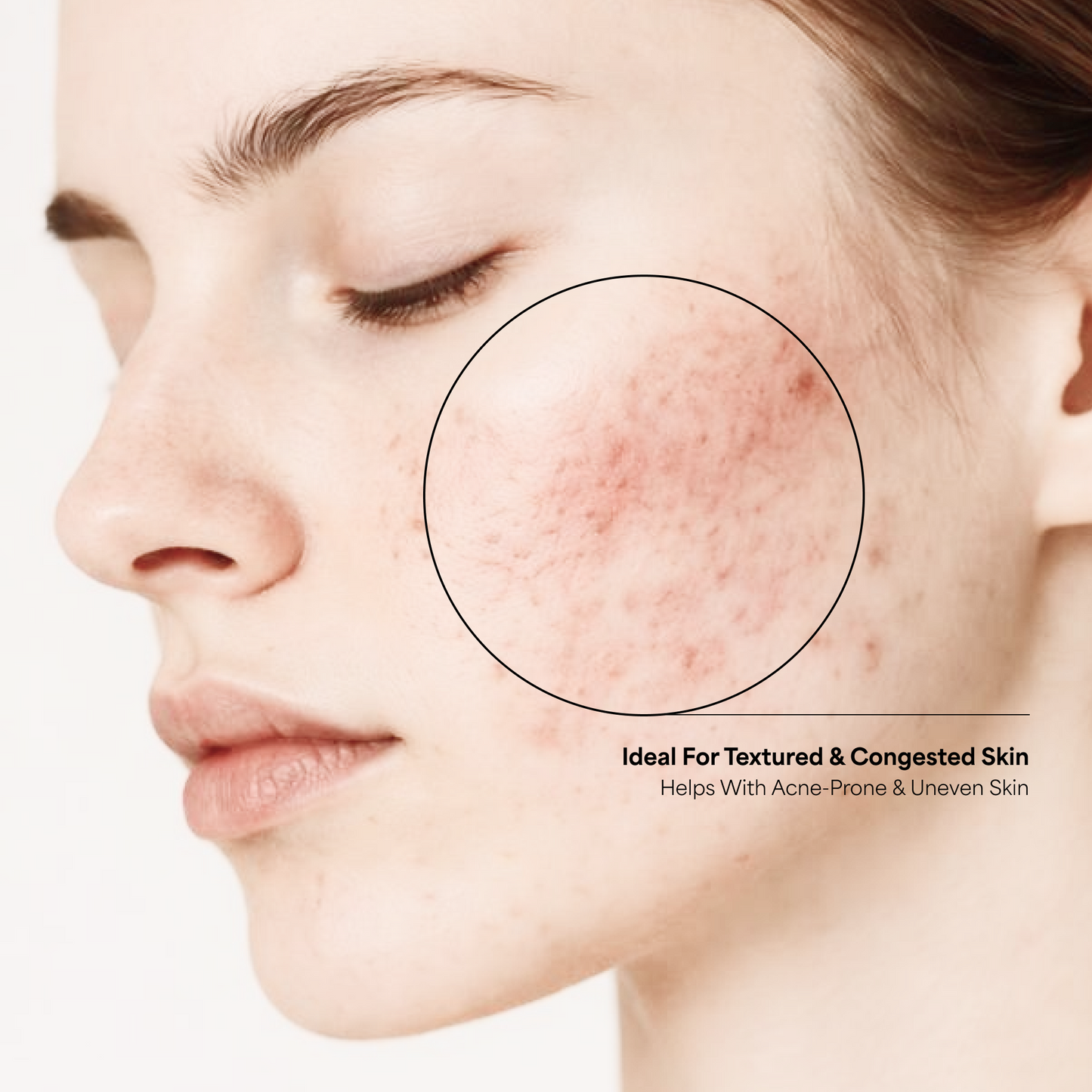 AHA BHA PHA 30% Serum