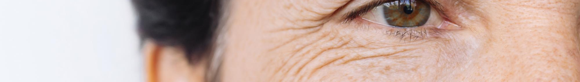 Wrinkle & Fine Lines